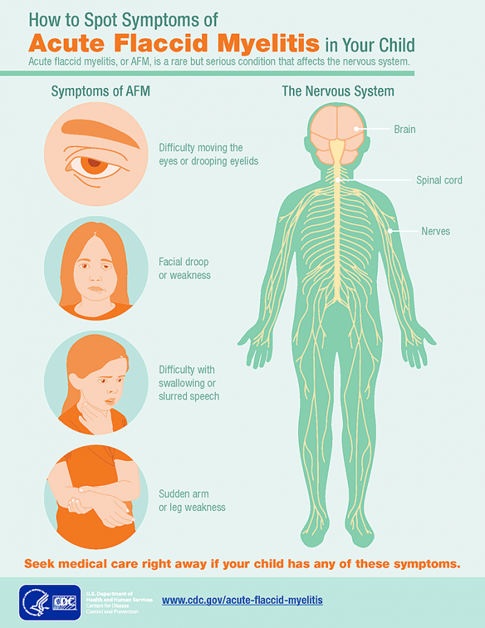 CDC confirms 90 cases of Acute flaccid myelitis (AFM)